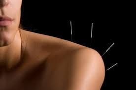 Acupuncture needles treatment