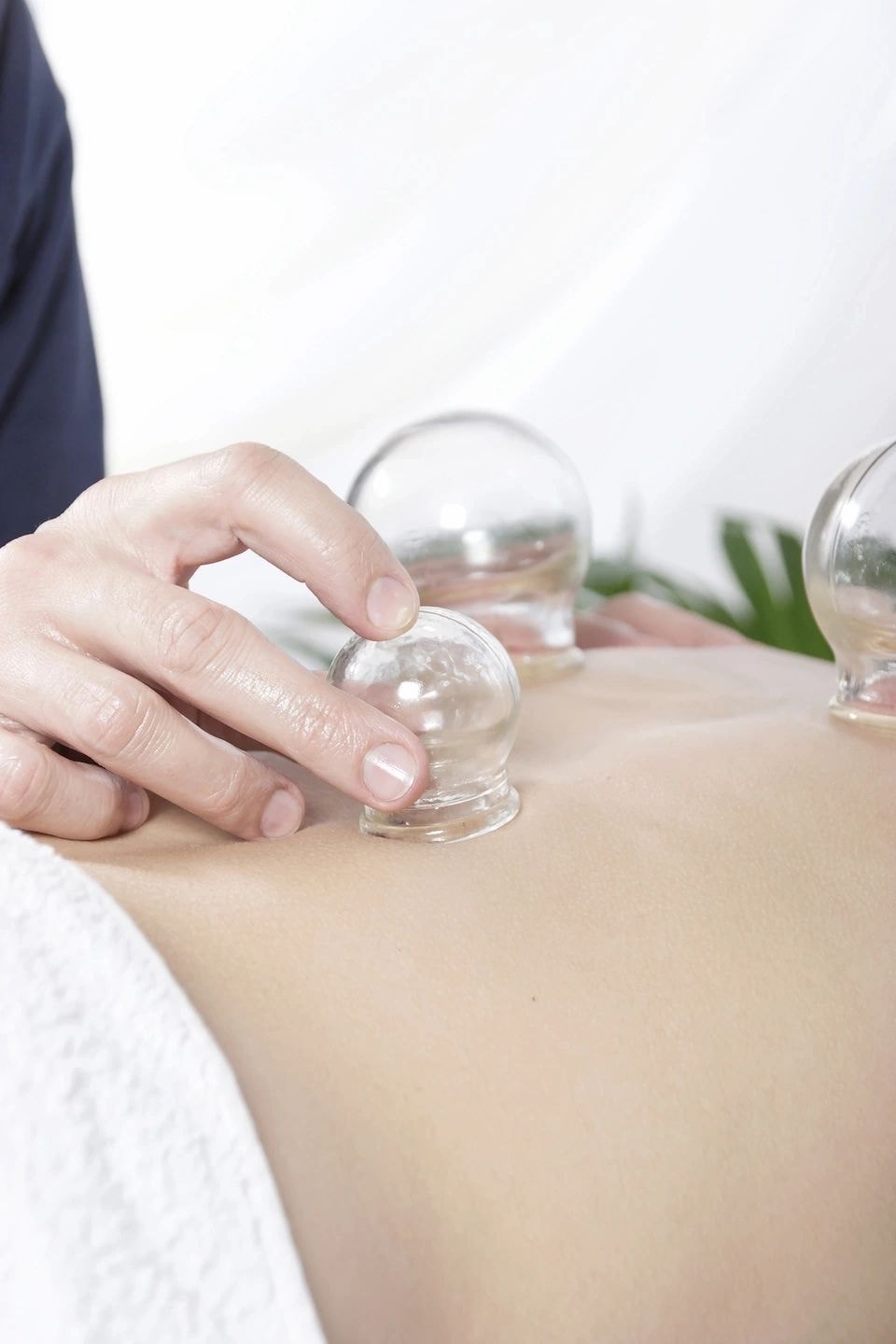 Cupping therapy