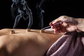 Moxibustion treatment